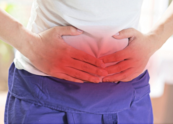 Hernia