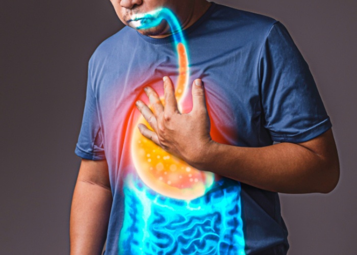 reflux